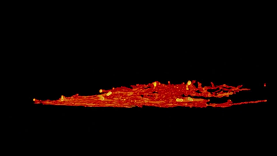 Tubulin Imaging